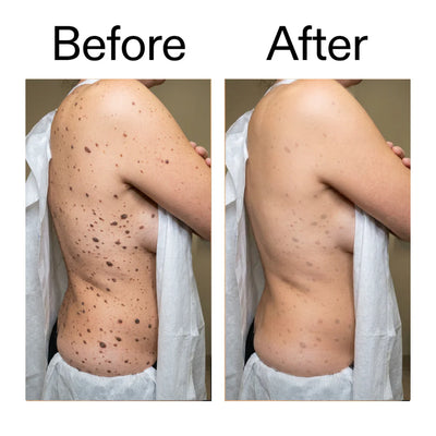 Smooth & Even Glycolic Body Stick